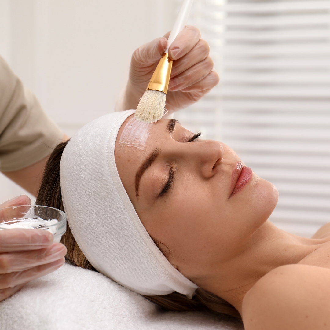 Chemical Peels